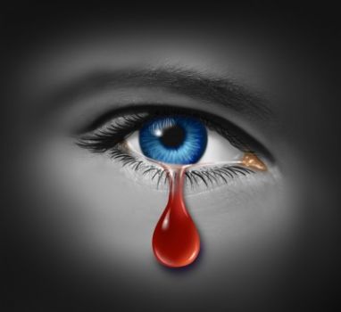 Lacrima di sangue