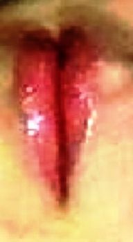 False labbra