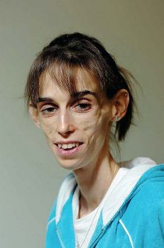 Chiss� quale male  