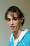Chiss� quale male  