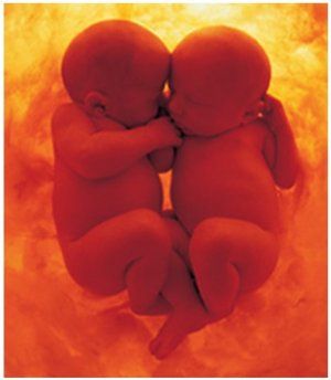 I gemelli